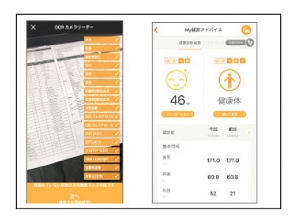 「タブレット端末をかざすだけでカラダの健康状態が分かる「健康年齢(R)OCR サービス」を提供開始」の見出し画像